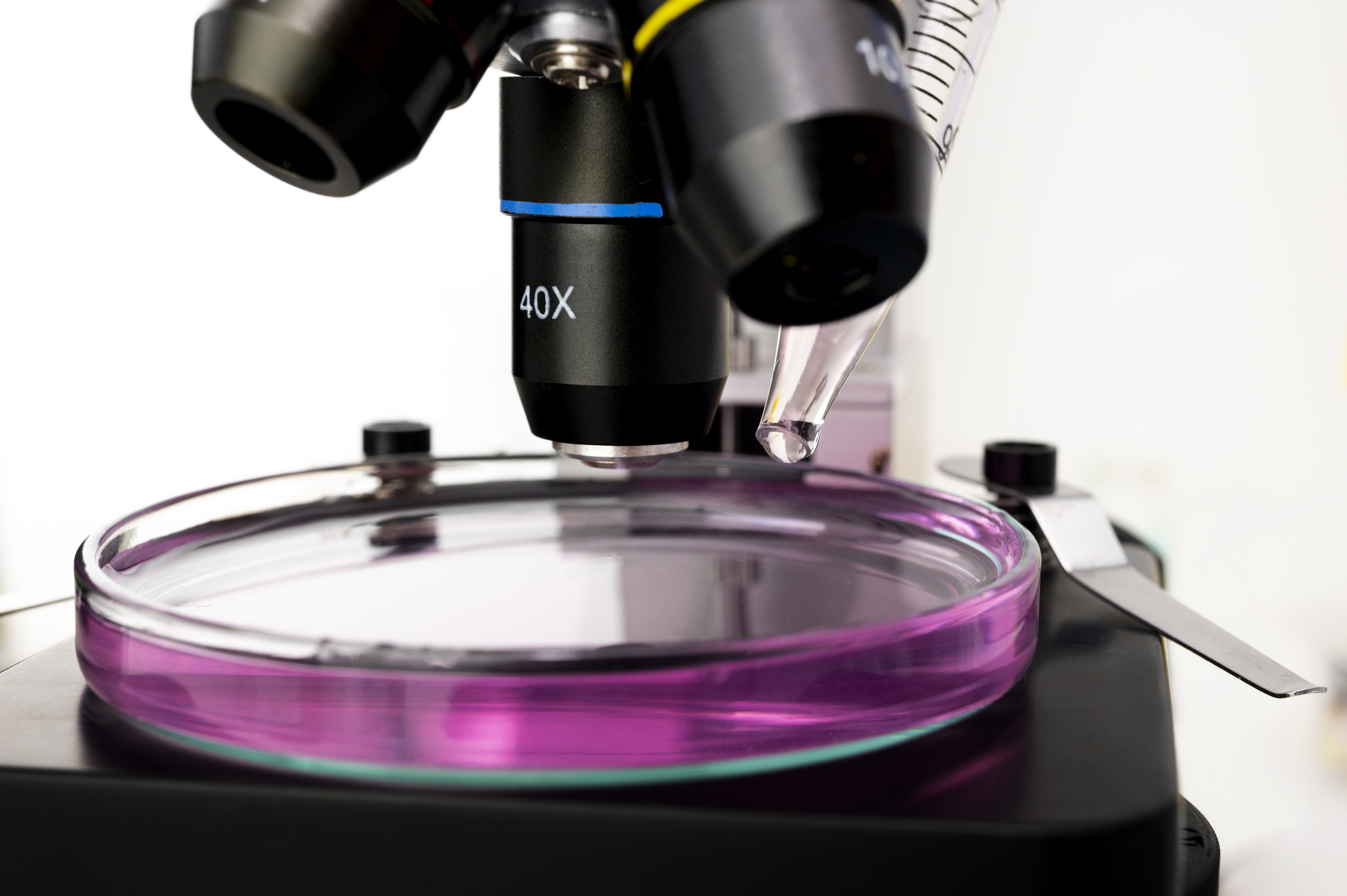 Advanced Microscopic Analysis for Malaria Detection